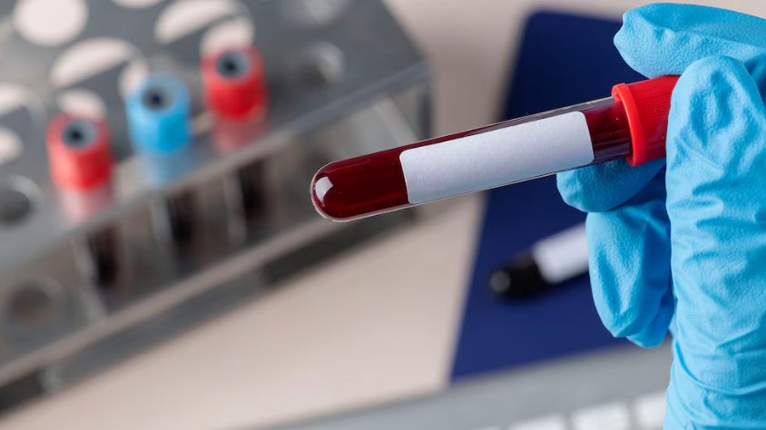 Japón está desarrollando sangre artificial universal