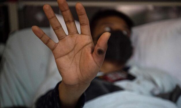 Se mantiene la alerta global por la epidemia de mpox