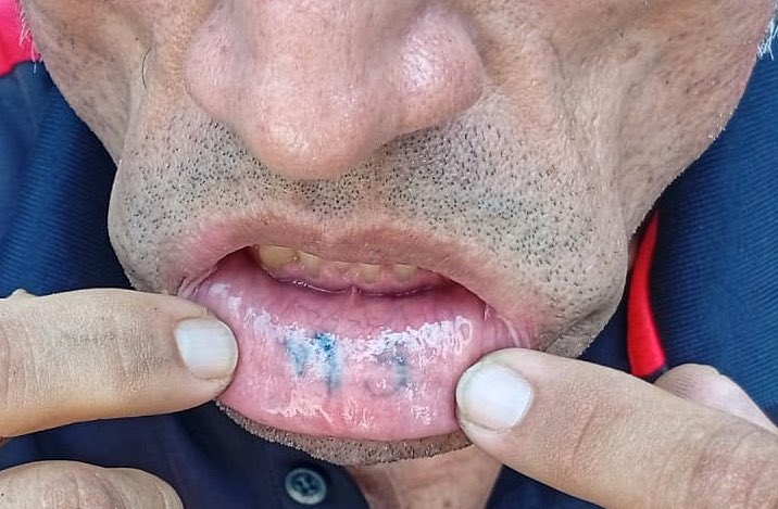 Capturan a pandillero salvadoreño que tiene tatuado alusivos a la pandilla en los labios